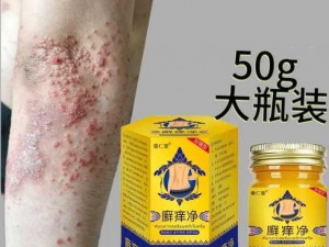 草本抑菌乳膏，快速解决淑芳两腿间又痒了 50 岁的问题